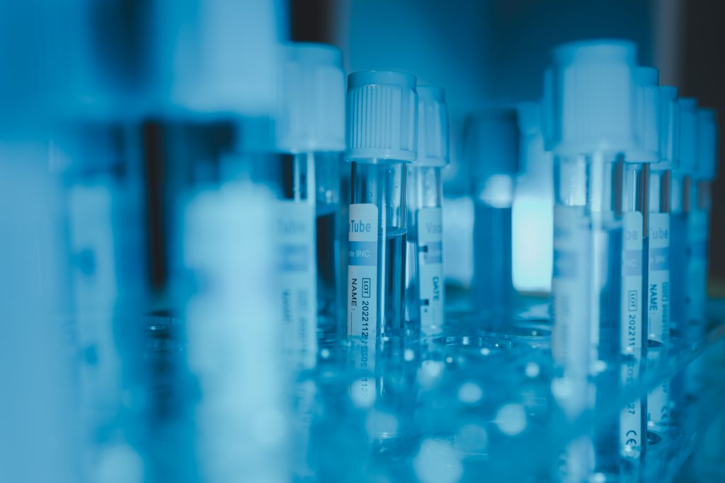 Our Story Lab Equipment